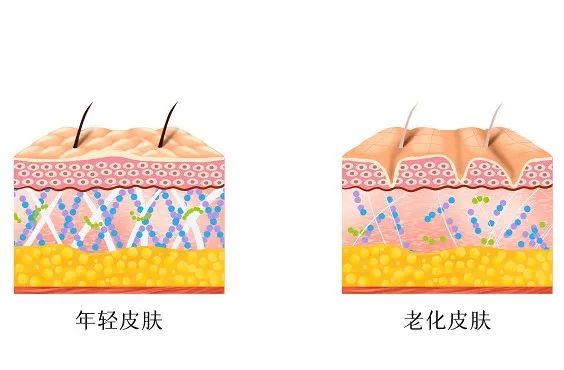 外阴白斑患者为什么还要戒糖? 外阴白斑患者为什么还要戒糖?