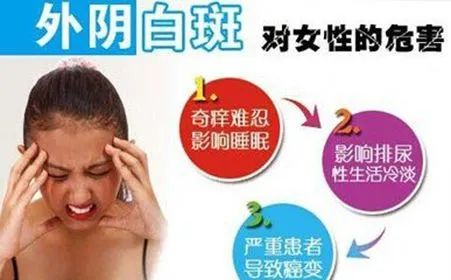 外阴白斑分几种? 外阴白斑分几种?