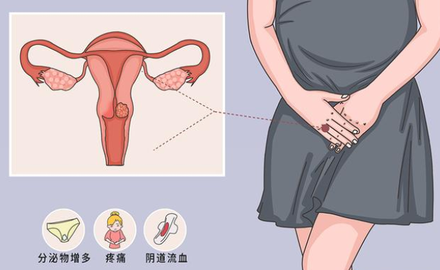 昆明良方外阴白斑研究中心 女性如何做好私处护理