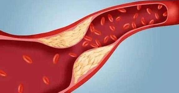 秋冬季节外阴白斑为何加重 秋冬季节外阴白斑为何加重